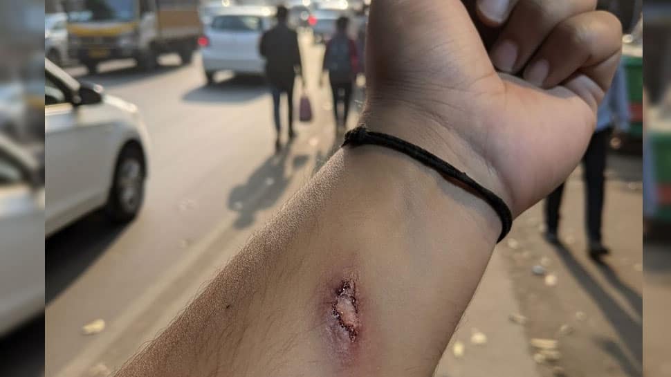 Employee Makes HR Approve His Paid Leaves With AI Generated Injury Pic