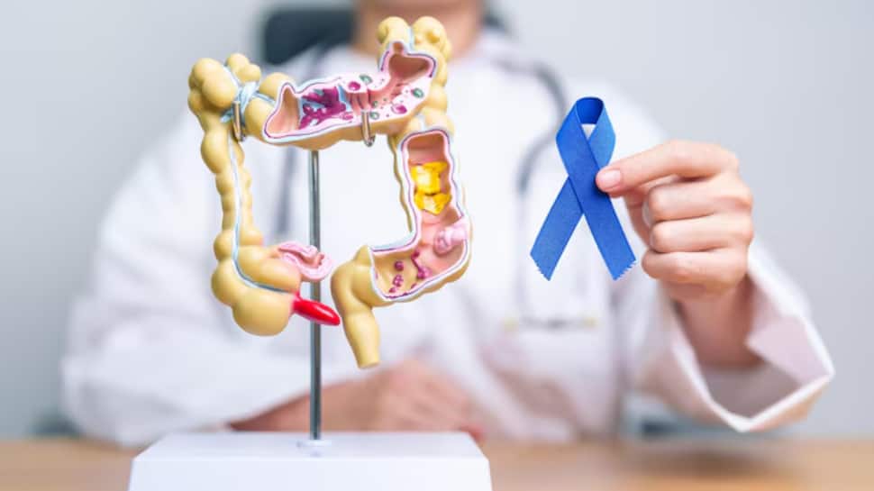 Why blood in stool is often misdiagnosed as piles: Overlooked symptoms of colorectal cancer