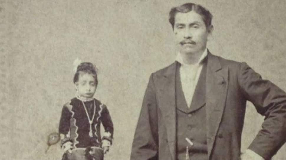 The real-life Lilliputian: Meet Lucia Zarate, the world`s lightest girl who weighed less than a house cat