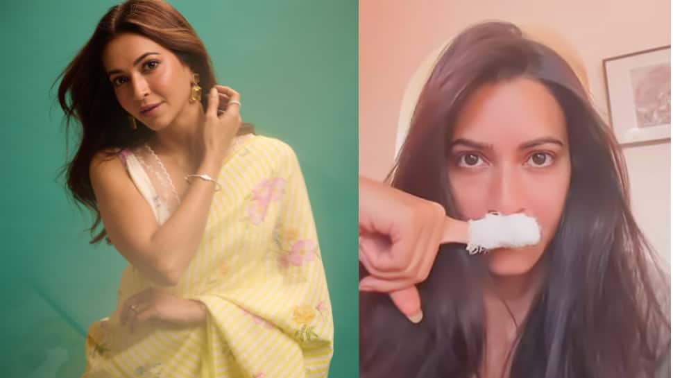 Kriti Kharbanda injured during vacation, shares photos of bandaged leg and finger on social media