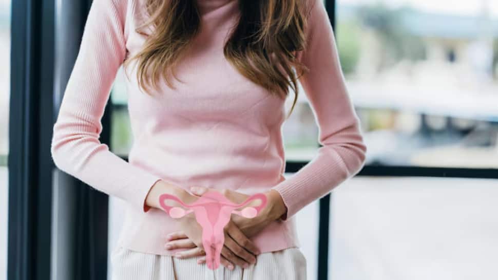 PCOS name changed to PMOS: Experts reveal why it is important to look beyond just ovarian health