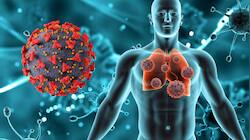 Can modern urban living worsen autoimmune conditions? 