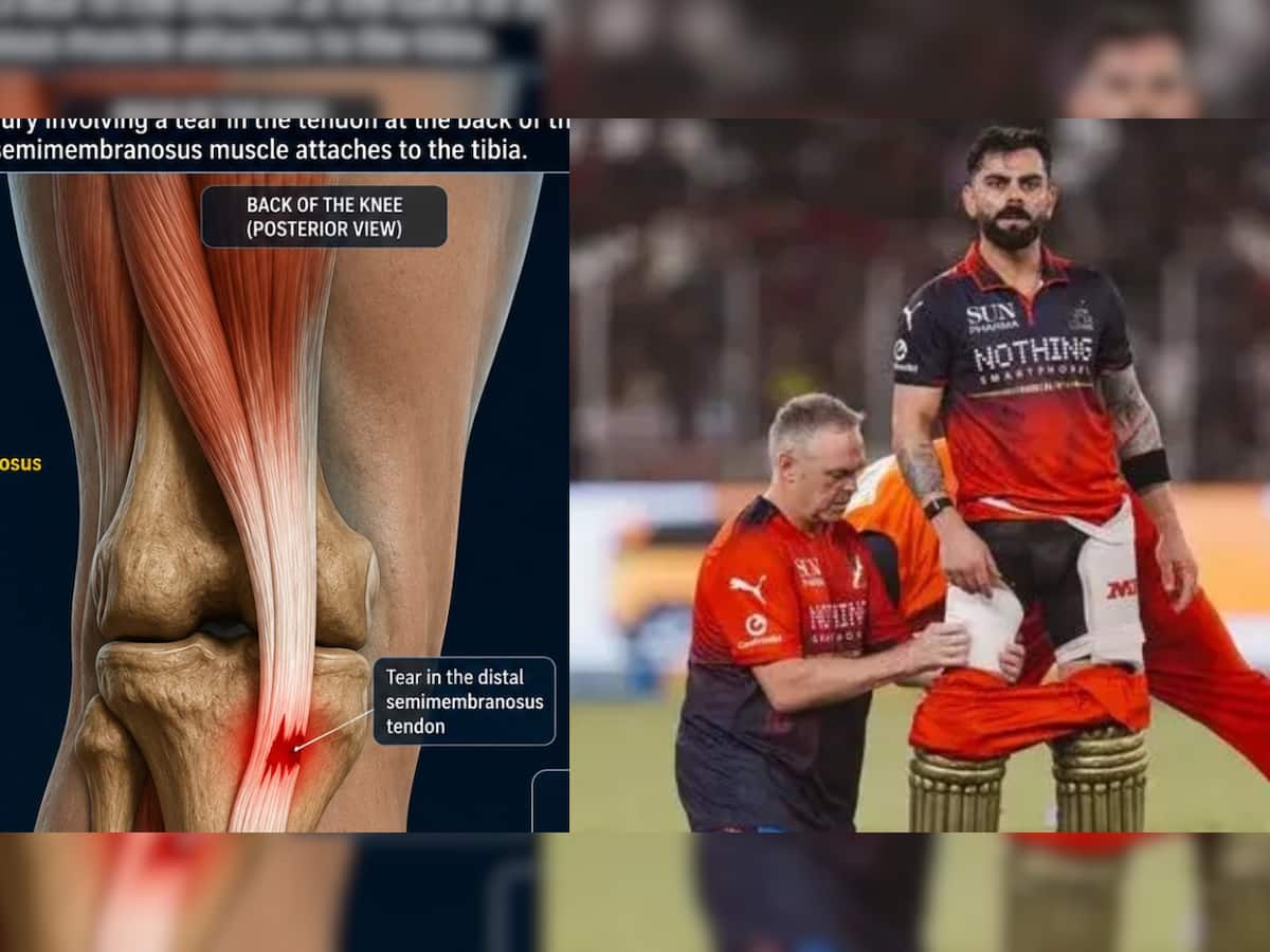Virat Kohli’s not just a hamstring: The frighteningly unusual injury that has ruled him out and threatens England tour