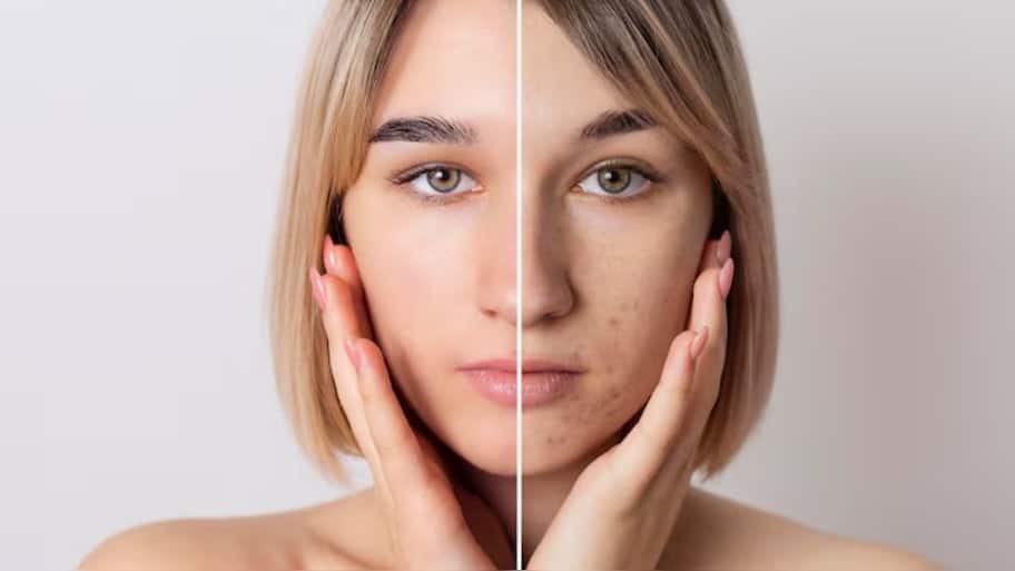 Dark spots won’t fade until you fix this hidden skin issue, experts reveal
