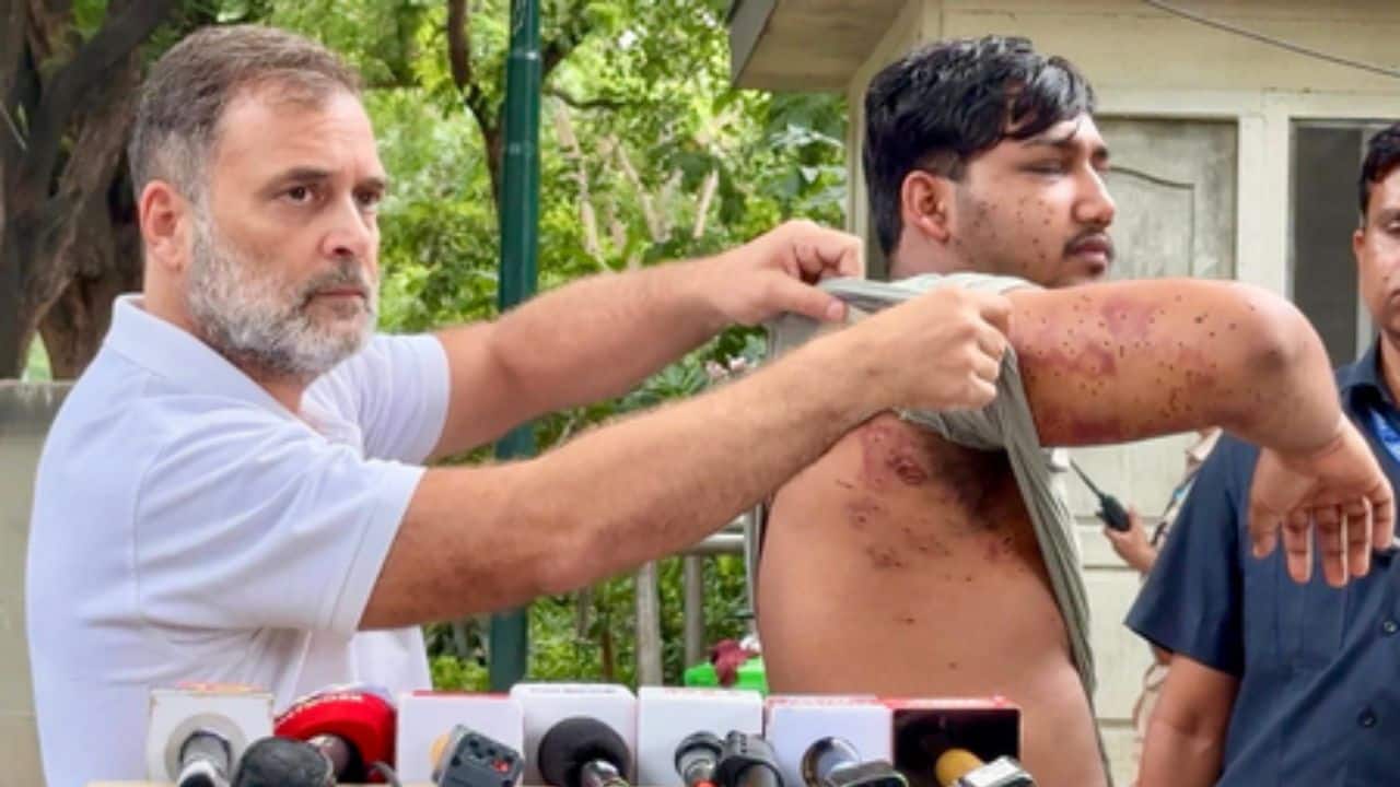 Rahul Gandhi accuses Centre of ‘lying’ on pellet use during CJP stir