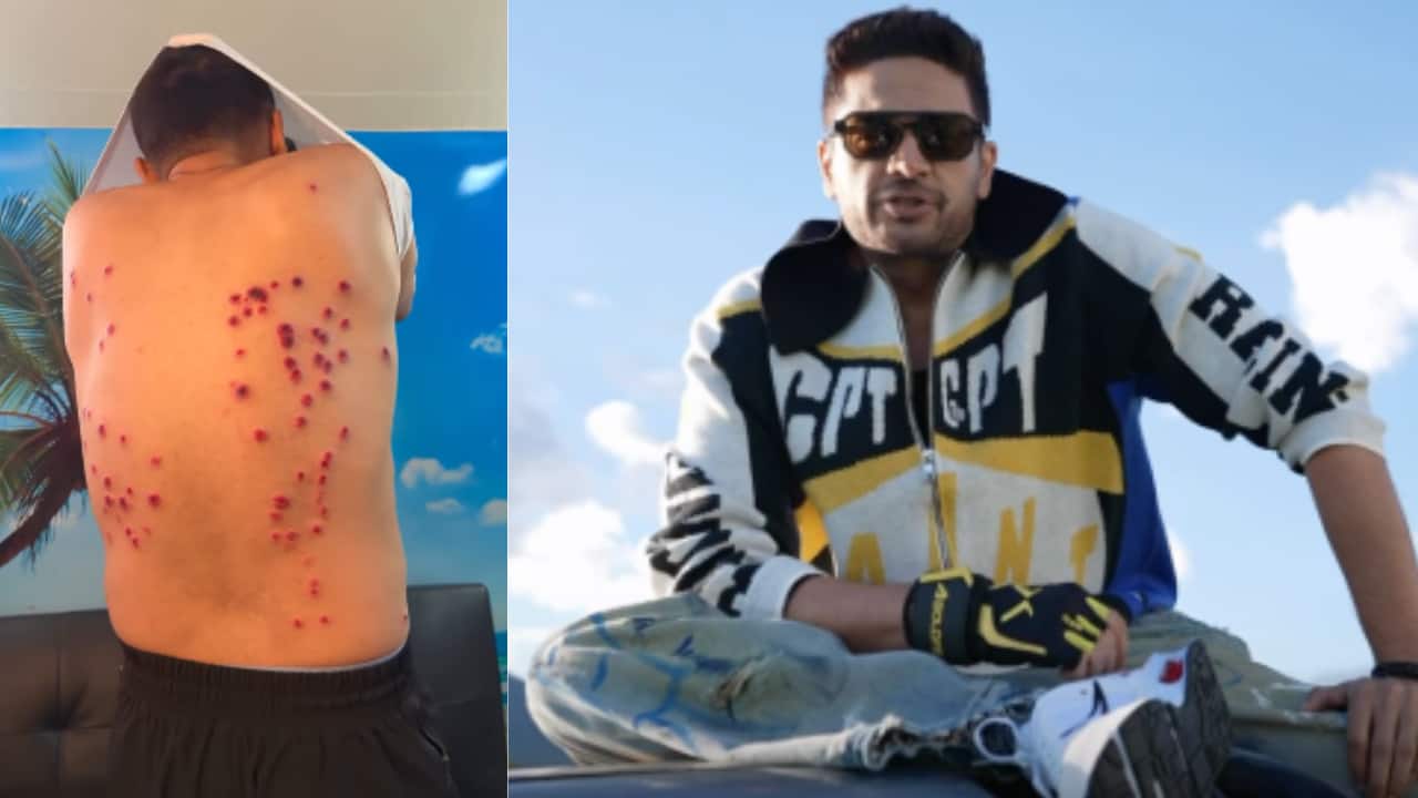 'Khatron Ke Khiladi 15': Gaurav Khanna suffers severe back injuries in brutal stunt