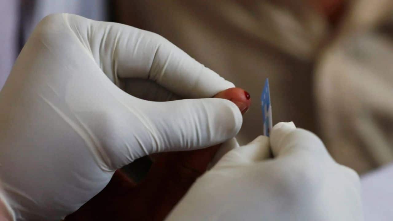 Swine flu cases rise amid humid weather; doctors advice caution, respiratory hygiene