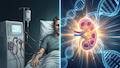 World first: Pig kidney saves man facing 7-year dialysis death sentence