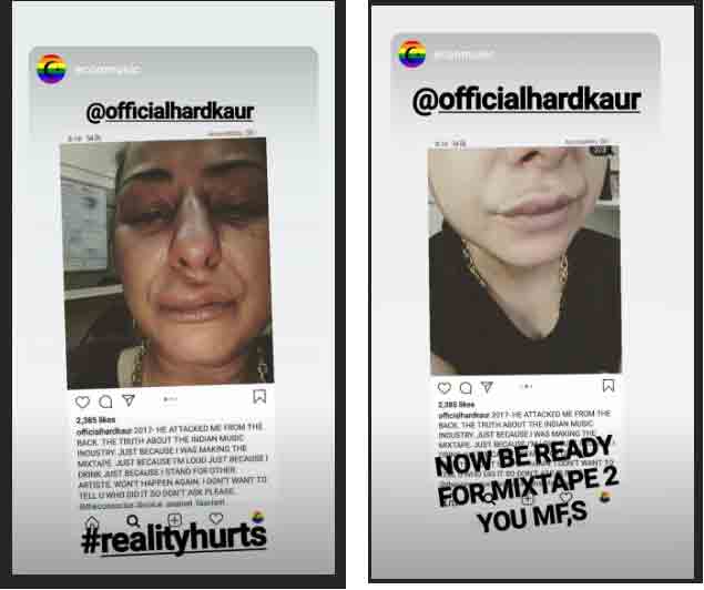 Hard Kaur Xxx Videos - Rapper Hard Kaur accuses Mo Joshi of assault, shares a detailed post on  social media | People News | Zee News