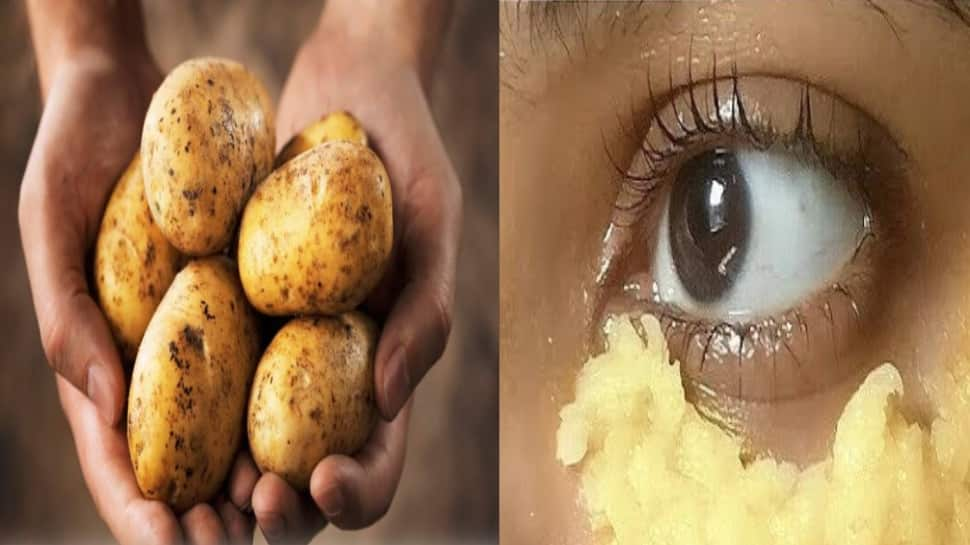 How to Remove Dark Circles Naturally at Home