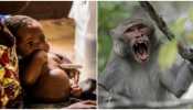 Monkeypox outbreak started in India? Doctors advises to follow THIS path, not to...