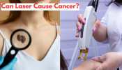 Can Laser Cause Cancer? Check Expert&#039;s Say On This
