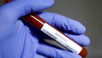Coronavirus can infect you within 5 to 50 minutes: Study