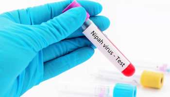 Nipah virus in Karnataka? Infection suspected in patient in this city