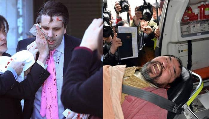 US envoy to South Korea Mark Lippert slashed on wrist, face; North justifies attack