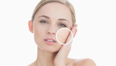 Tackle summer skin problems with extra care