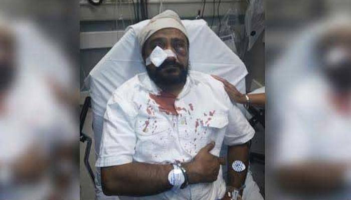 Sikh-American assault: US won&#039;t press hate crime charges, calls it &#039;road rage&#039;