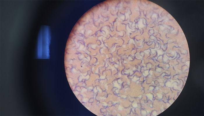Sleeping sickness parasite owes extinction to “stagnant sex life”