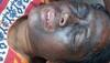 Attack on AAP leader Soni Sori: Police says it wasn't acid
