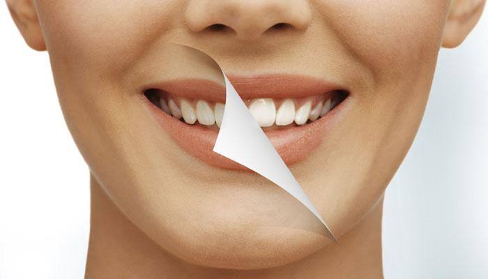 Home remedies for shiny, white teeth - Check out