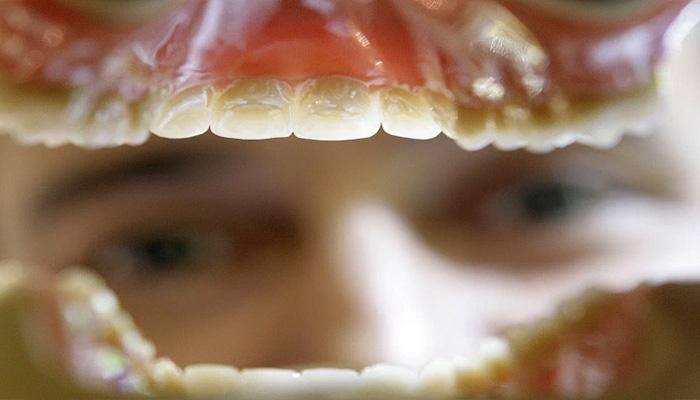 `Dentist of horror` on trial for mutilating French patients, faces $165,000 fine