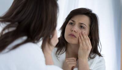 Worried about the dark circles under your eyes? Check out home remedies to get rid of them