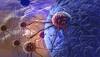 Journal of the National Cancer Institute