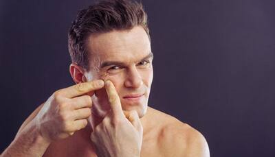 Skincare tips for men to get rid of pimples