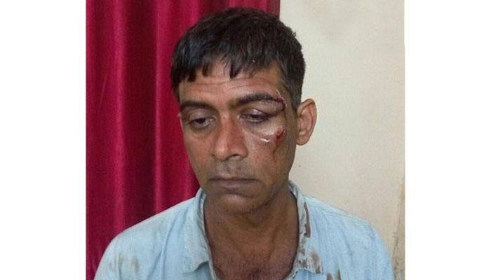 Delhi: Africans thrash Ola cabbie for refusing to carry extra passengers