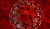 Acquired immunodeficiency syndrome