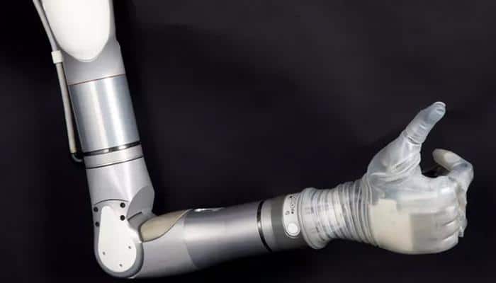 Coming very soon! Luke prosthetic arm that will change lives of amputees (Watch video)