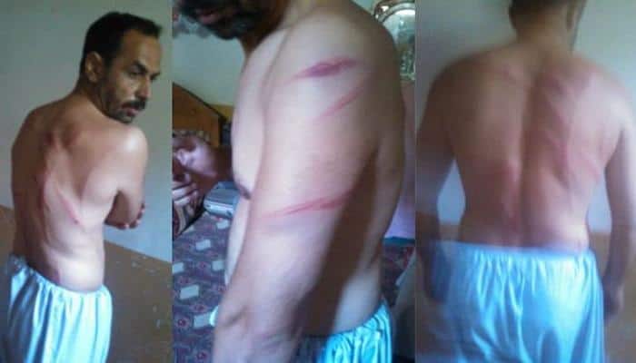 Police brutality in Pakistan-occupied Kashmir’s Gilgit-Baltistan area – Know the gory details