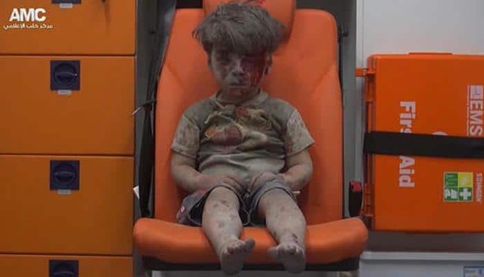 US calls dazed boy &#039;the real face&#039; of Syria&#039;s war