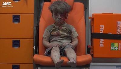 US calls dazed boy 'the real face' of Syria's war