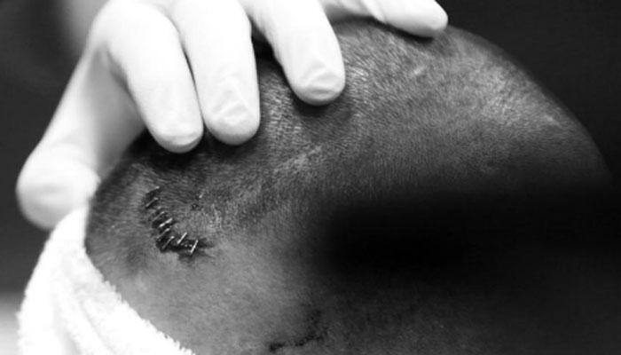 PHOTOS: BRUTAL! Randy Orton receives 10 staples after Brock Lesnar's assault at SummerSlam