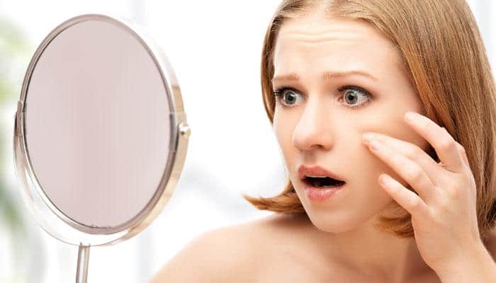 This amazing beauty hack will HIDE your pimples easily! Watch video