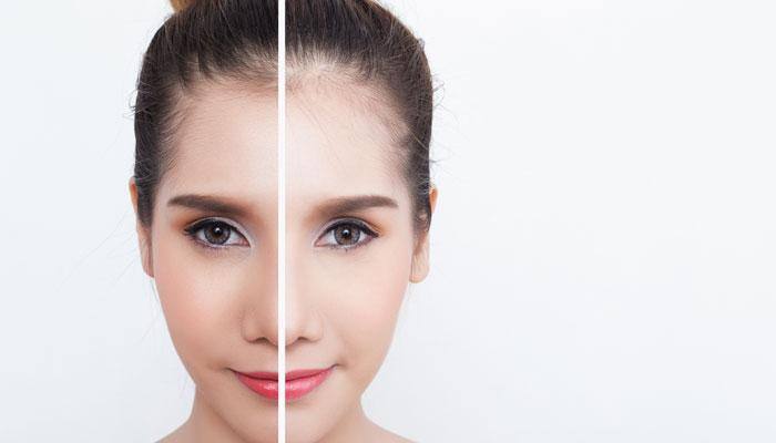 Going for skin lightening, whitening solutions? Rethink