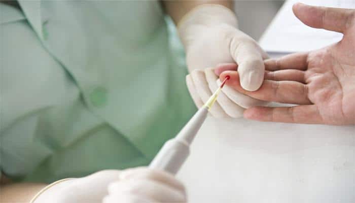 Old blood as good as new for patient survival: Study