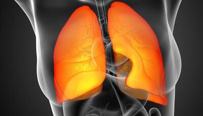 Lab-grown mini lungs to help study respiratory diseases