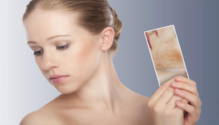 Suffering from eczema? Try these natural remedies to treat the skin condition! Suffering from eczema? Try these natural remedies to treat the skin condition!