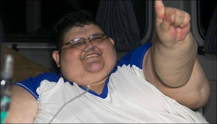 World's most obese man, weighing 79 stone, begins weight loss treatment in Mexico