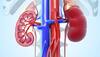 Bioartificial kidney