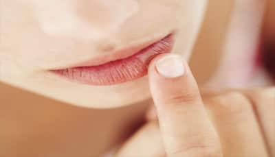 Winter special: Try these home remedies to cure chapped lips!