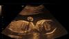 Embryo development