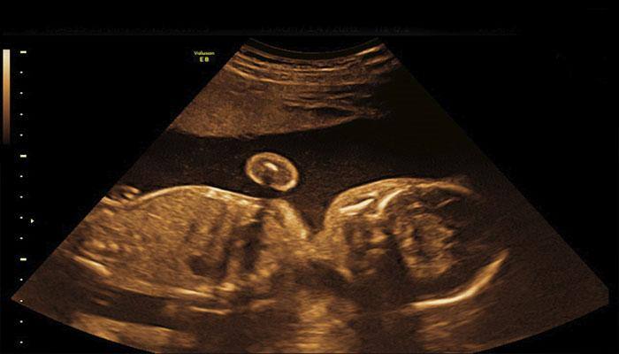 Scientists find way to 'pause' embryo development for upto a month 