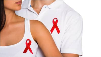 Five facts you need to kow about HIV/AIDS