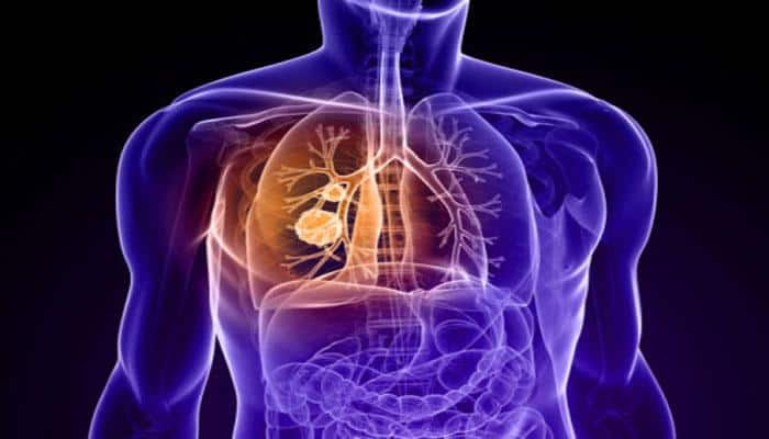 Drug gives lung cancer patients four extra months