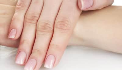 Suffering from swollen fingers? Try these simple natural remedies to get relief from it!