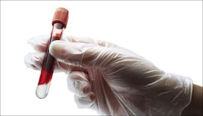 Your blood test has the answer to how long will you live