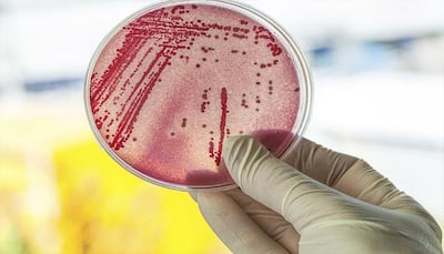 'New Delhi' superbug: US woman dies of infection resistant to all available antibiotics
